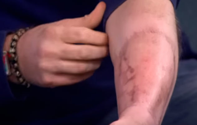 Andrew Wardle föddes utan penis. Andrew Wardle föddes utan penis.